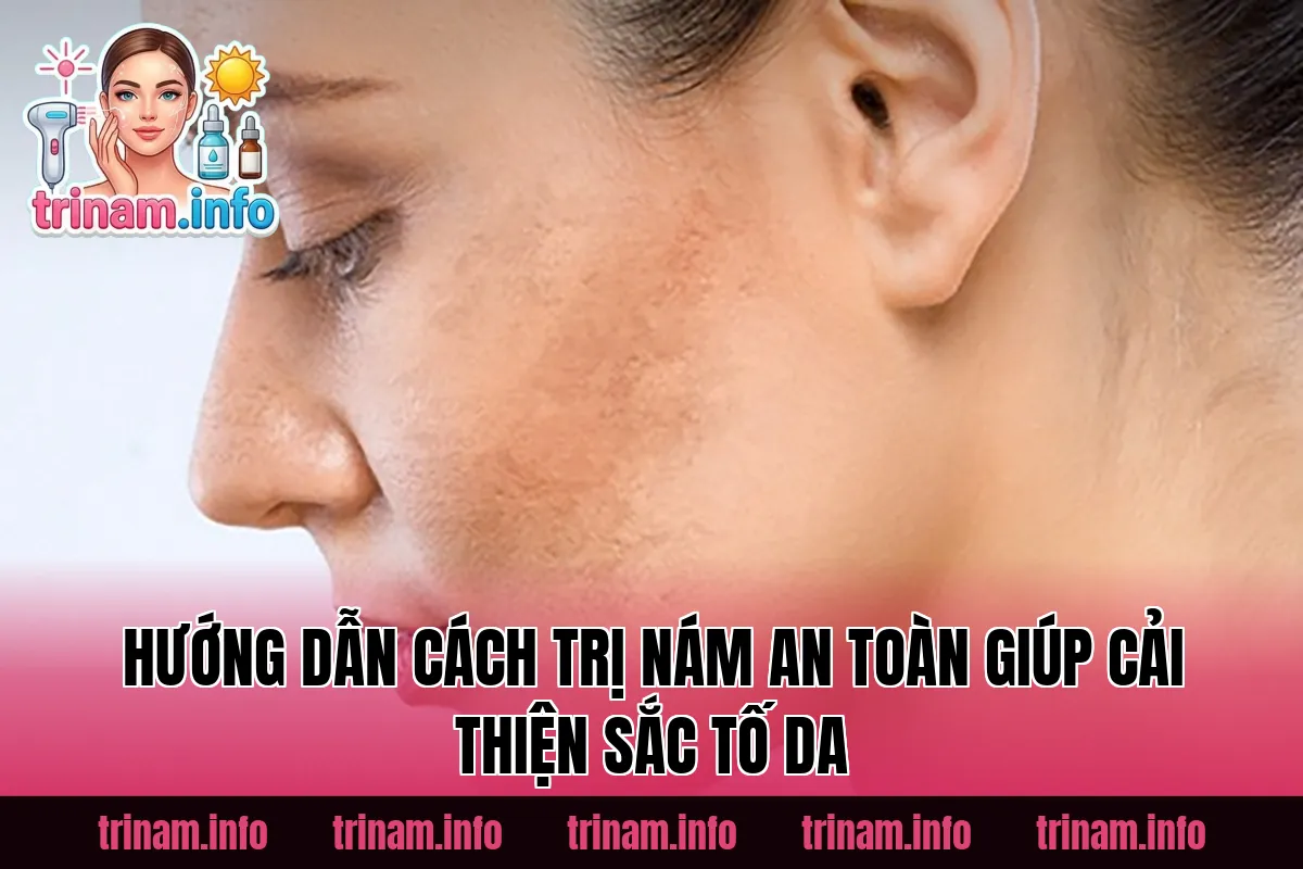 Hướng dẫn cách trị nám an toàn giúp cải thiện sắc tố da
