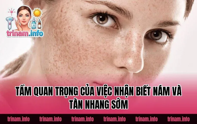 Tầm quan trọng của việc nhận biết nám và tàn nhang sớm