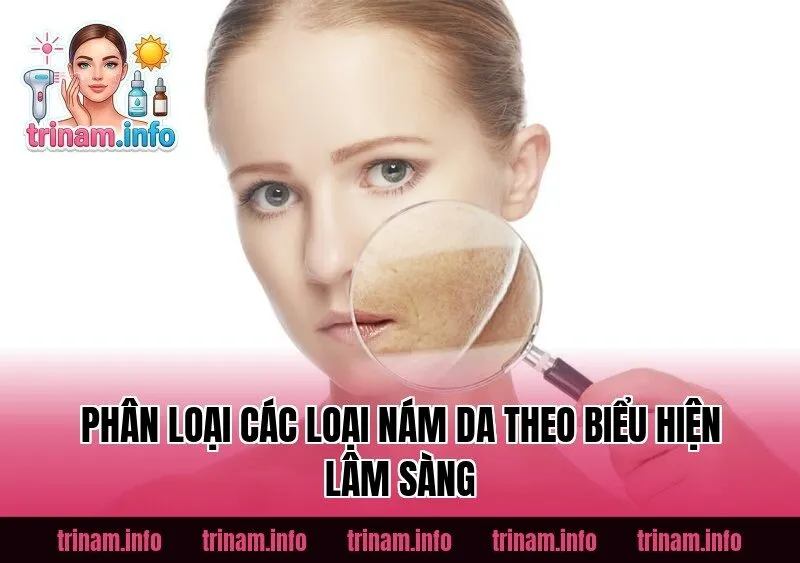 Phân loại các loại nám da theo biểu hiện lâm sàng
