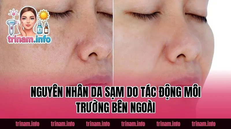 Nguyên nhân da sạm do tác động môi trường bên ngoài