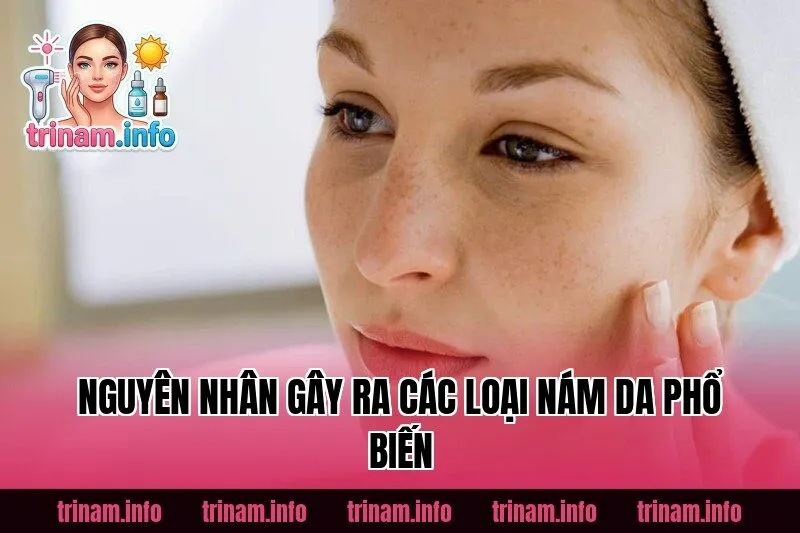Nguyên nhân gây ra các loại nám da phổ biến