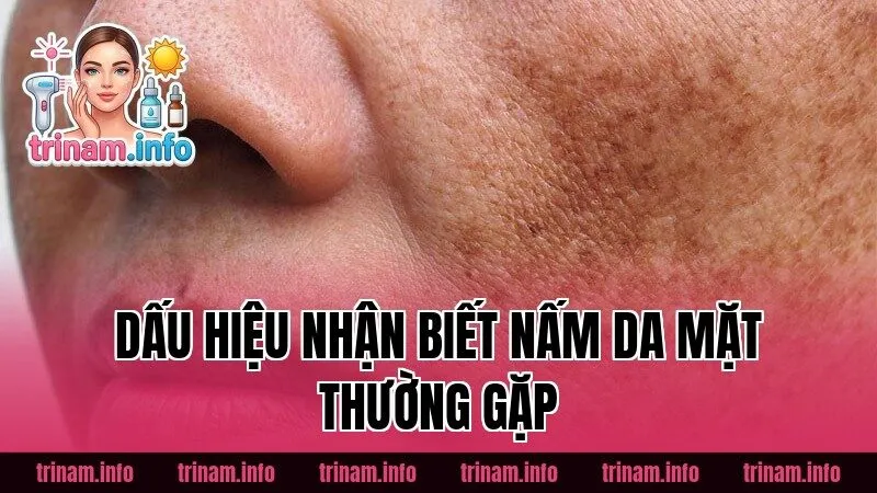 Dấu hiệu nhận biết nấm da mặt thường gặp