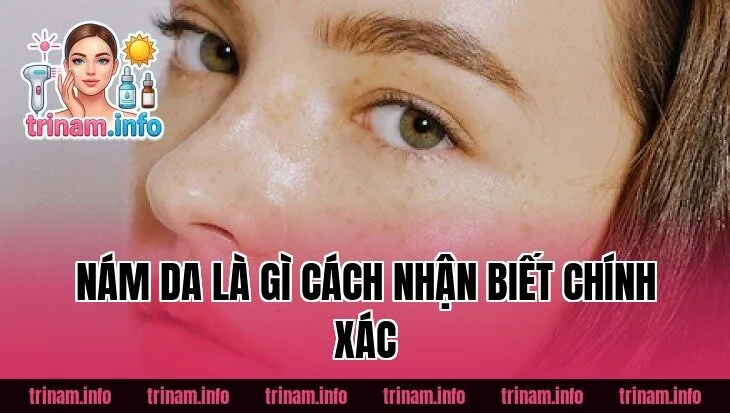 Nám Da Là Gì Cách Nhận Biết Chính Xác