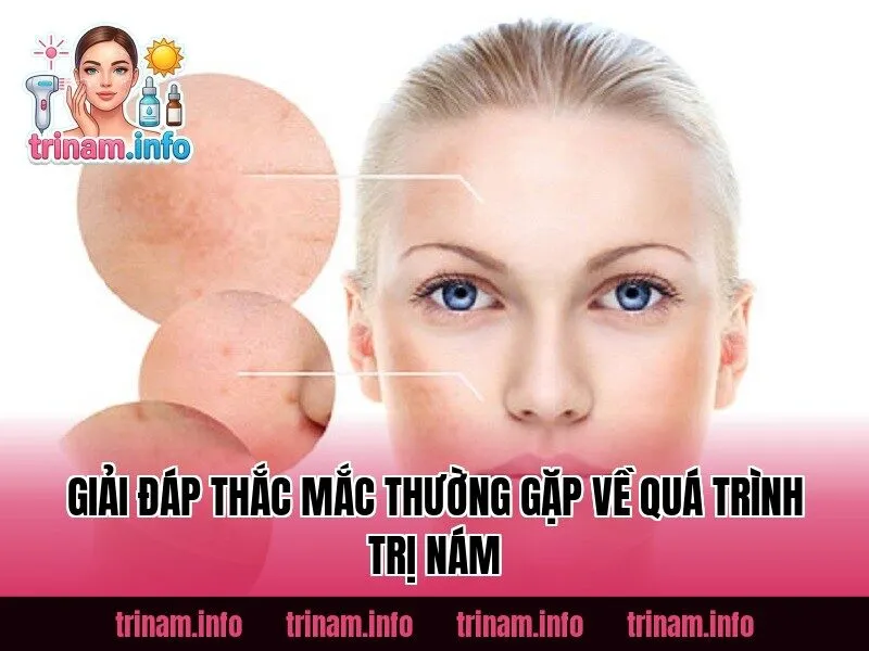 Giải đáp thắc mắc thường gặp về quá trình trị nám