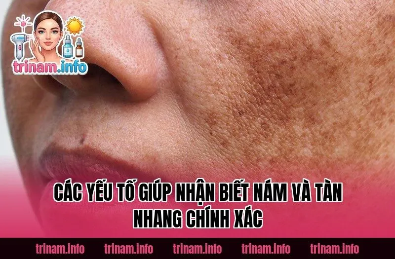 Các yếu tố giúp nhận biết nám và tàn nhang chính xác