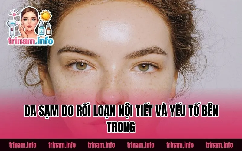 Da sạm do rối loạn nội tiết và yếu tố bên trong