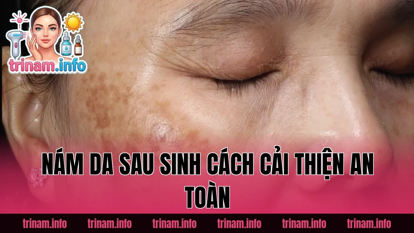 Nám Da Sau Sinh Cách Cải Thiện An Toàn