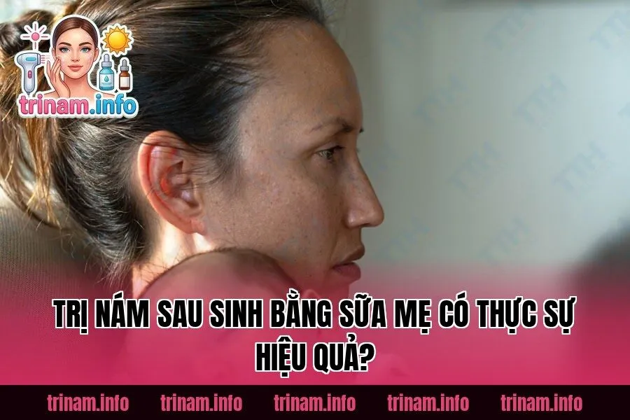 Trị Nám Sau Sinh Bằng Sữa Mẹ Có Thực Sự Hiệu Quả?