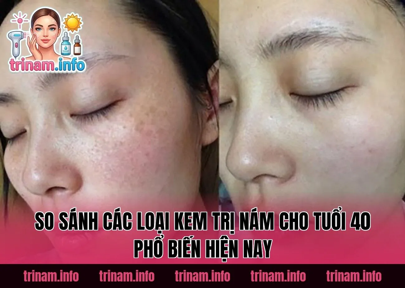 So sánh các loại kem trị nám cho tuổi 40 phổ biến hiện nay