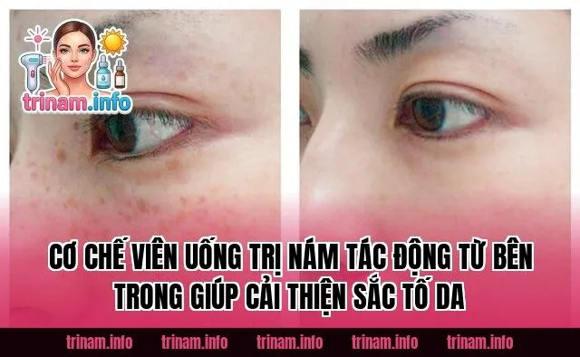 Cơ chế viên uống trị nám tác động từ bên trong giúp cải thiện sắc tố da