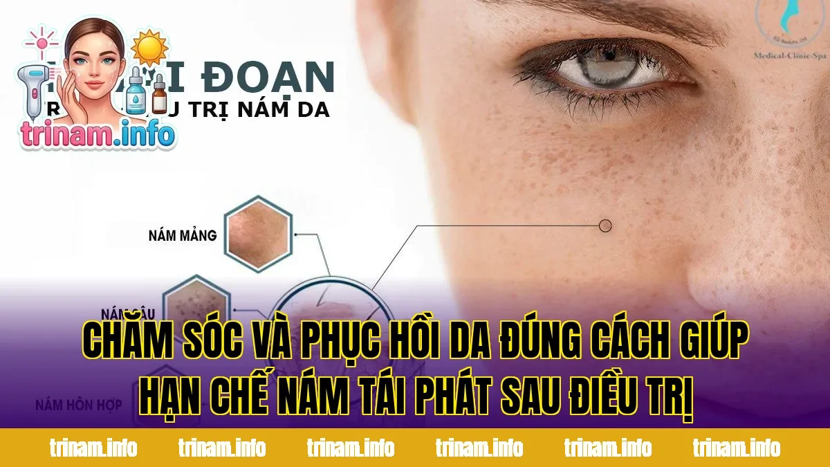 Chăm sóc và phục hồi da đúng cách giúp hạn chế nám tái phát sau điều trị