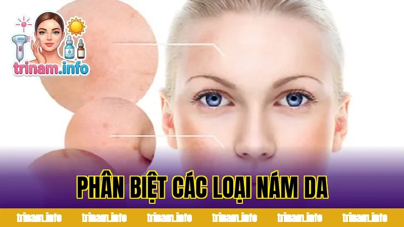 PHÂN BIỆT NÁM DA CÁC LOẠI